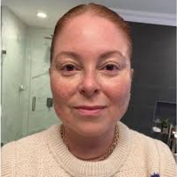 JOANNA VARGAS MAGIC SERUM
SOOTHING SERUM | 1 FL OZ / 30 ML - Picture 6 of 15